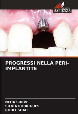PROGRESSI NELLA PERI-IMPLANTITE Neha Surve