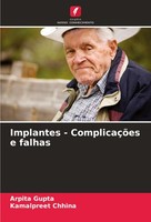 Implantes - ComplicaçõEs E Falhas Kamalpreet Chhina