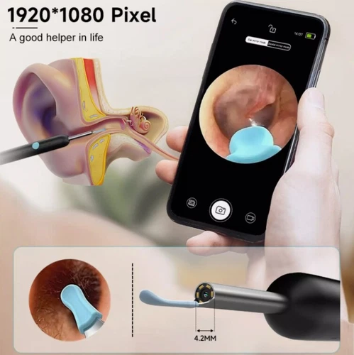 NEW LED Ear Wax Cleaner Ear Camera Otoscope with Light Cleaner Removal Kit Black - Picture 7 of 10