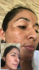 Crema DEAMANCHADORA, SPOT CREAM /crema DESMANCHADORA Y Revitalizadora