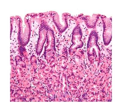 Set of 100 Microscope Prepared Typical Histology Slides for Medical Study Edu...