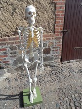 Original SOMSO Skelett Modell Mensch - Anatomie Lehrmodell - guter Zustand.