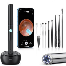 Ear Wax Removal Camera Ultra-HD Ear Wax Remover Tool, Ear Cleaner Washer kits
