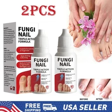 2PCS Fungi Nail Anti Fungal Liquid Formula Nail Repair Liquid Solution 15ml