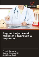 Augmentacja Tkanek Mi¿Kkich I Twardych W Implantach Preeti Karhana
