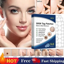 2025 Skin Tag Remover Patches Quick Effective Mole and Wart Pad Removal Sticker