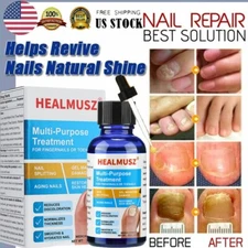 HEALMUSZ 30ml Toenail Fungus Treatment for Nail & Fingernails Repair Solution