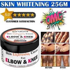 New Strong Whitening Cream For Removing Dark Knuckle Finger Elbow and Knee US