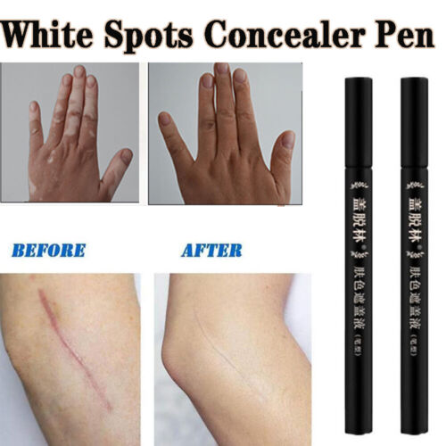 Scars Cover Pen White Spots Concealer Camouflage Makeup Tattoo Concealer Liquid - Picture 1 of 12