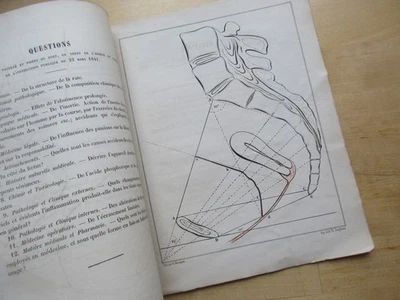 OBSTETRIQUE CONSIDERATION SITUATION NORMALE UTERUS VACUITE CANAL VAGINAL 1864 - Photo 1/4