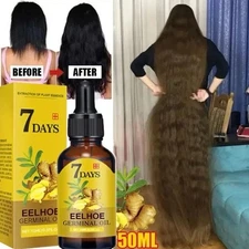 (Pack of 2 ) 7 Day Fast Hair Growth Oil Ginger Growth Hair Treatment