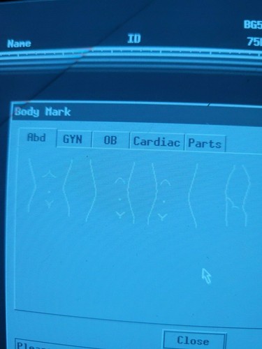 Mindray DP-6600 Ultrasound with 2 Transducers - Picture 10 of 12