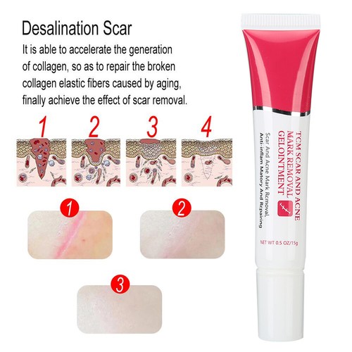 TYJR Scar Removal Cream Face Body Repair Gel Skin Repair Dark Spot Cream 15 AU - Picture 4 of 12