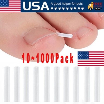 10pcs/set Ingrown Nail Pad Ortho Nail Filling Nail Groove Pad Corrector Artifact