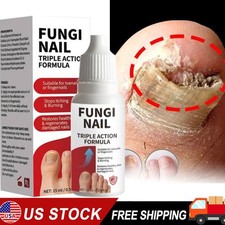 Fungi-Nail Anti-Fungal Liquid Solution Kills Fungus That Can Lead To Nail