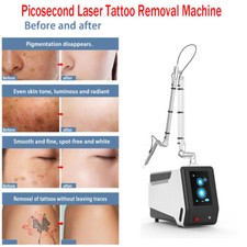 110V Picosecond laser tattoo removal machine for malasma pigment removal machine