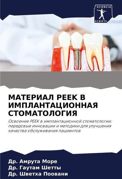 Amruta More (U. A.) | Material Peek V Implantacionnaya Stomatologiya | Buch-image