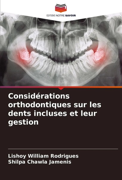 ConsidéRations Orthodontiques Sur Les Dents Incluses Et Leur Gestion Taschenbuch-image
