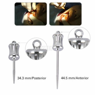 Dental Stainless Steel Manual Fragments Extractor Apical Root Extraction Drill