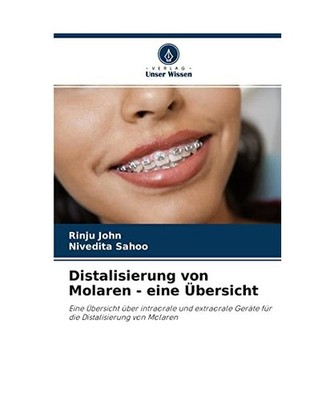 Distalisierung von Molaren - eine Übersicht: Eine Übersicht über intraorale u