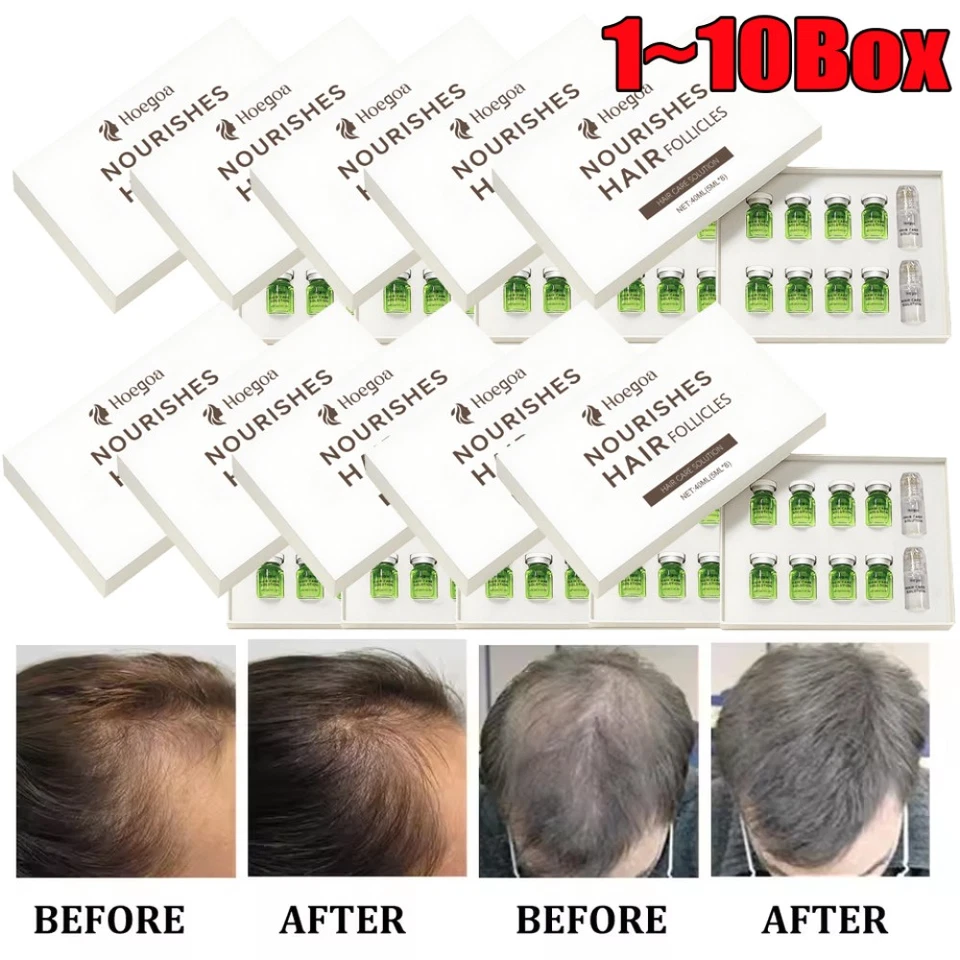 8Pcs/Set Microneedle Hair Regrowth System, Advanced Hair Treatment Ginseng Serum - Image 2 of 4