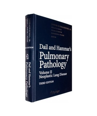 Dail and Hammar's Pulmonary Pathology: Volume II: Neoplastic Lung Disease: Volum