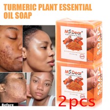 2PCS Tumeric Soap Skin Whitening Dark Spots lightening Acne Brightening Turmeric