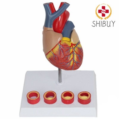 Vascular Heart Anatomy Model Heart Blood Vessel Specimen  Model