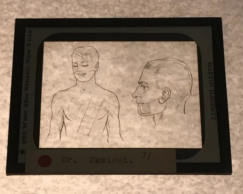Antique Medical GLASS SLIDE PLASTIC SURGERY 1930s Martin Haggett New York City 9
