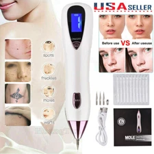 Anti-Aging Laser Plasma Pen Mole Removal Dark Spot Skin Tag Tattoo Wart Remover