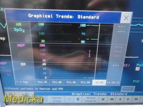2008 Philips Intellivue MP50 Anesthesia Patient Monitor W/ Modules & Leads~35179 - Picture 12 of 24