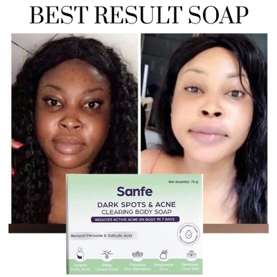 #ad #ad BEST EXTREME whitening Face Soap no need face cream Result In 1 To 2 Use $18.49