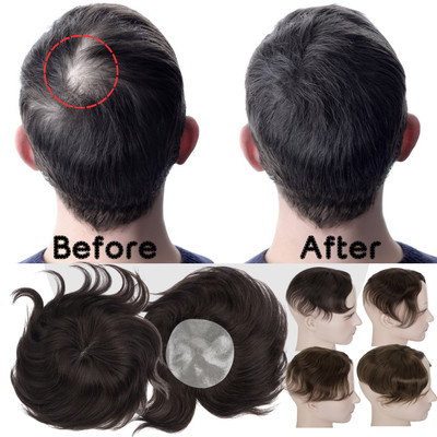 100% Human Hair Bald Spot Hair Patch Toupee for Men Full PU Skin Base Cover-up B