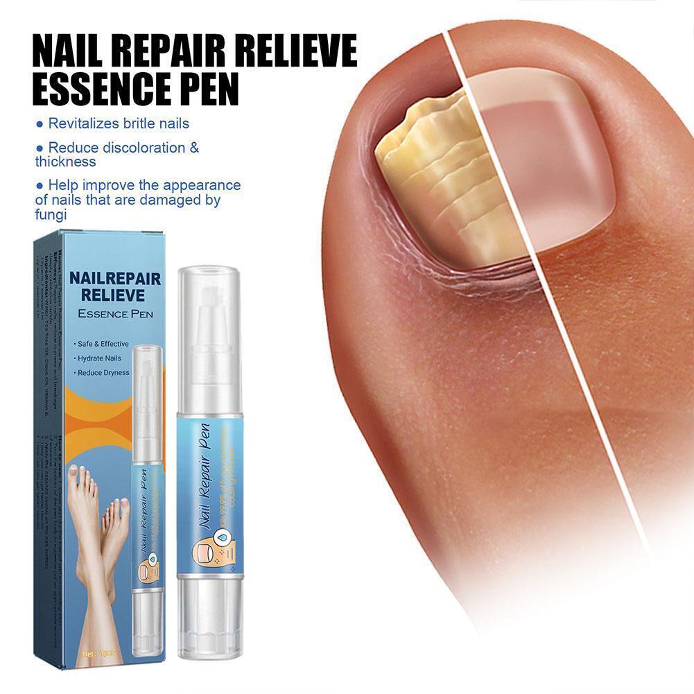 Lanthome Nail Fungus Treatment Pen Repair Revive Damaged Nails 4mL eBay
