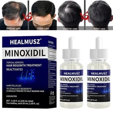 Minoxidil 5% Extra Strength Men Hair Regrowth Solution Treatment 2 Month Supply