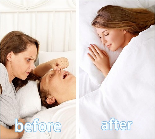 Anti Snoring Devices (6PCS), Nose Clip,Silicone Snoring... - Picture 2 of 8