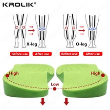 O/X-Leg Orthopedic Insoles Arch Support Insole Corrigibil Bow Legs Valgus Varus