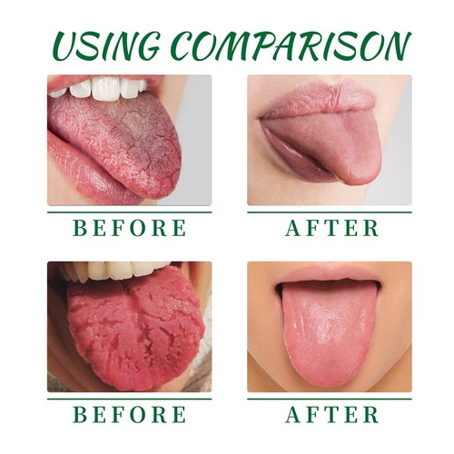 30ml Tongue Repair Spray Reduce Swelling Tongue Relief Treatment Spray - Imagen 3 de 9
