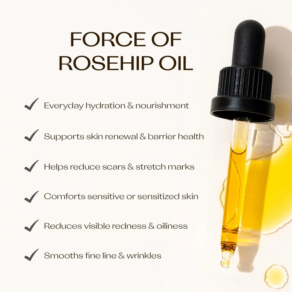 认证有机玫瑰果油,强效营养,改善... — 第 2/4 张图片