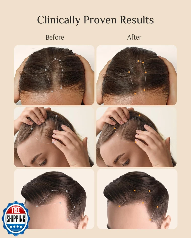 DR ZERO REDENICAL Hair Growth Shampoo for Women, 13.5 oz/400ml, Volumizing Th - Image 3 of 4