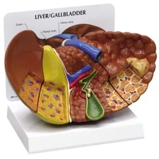 Liver Cancer GPI Anatomical Model w Key  LFA #3310. Make Us an Offer! SEE VIDEO