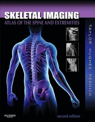 Skeletal Imaging: Atlas of the Spine and Extremities by DC Taylor, John A M: New