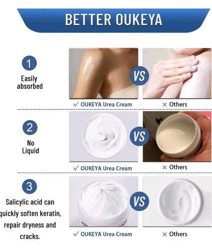  42% Urea Creme 10,58 Oz Hand und Füße Feuchtigkeitscreme Kostenloser schneller Versand  - Bild 6 von 9