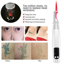 Portable Picosecond Laser Pen Red Light Tattoo Dark Spot Acne Scar Removal - USA