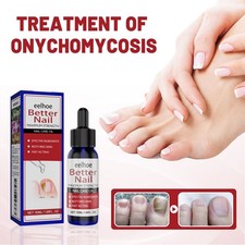 Nail Repair Liquid Antifungal Treatment for Fingernail & Toenail Care 50ml