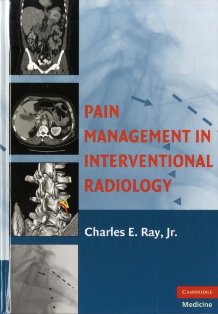 Pain Management in Interventional Radiology by Jr., Charles E. Ray HARDBACK
