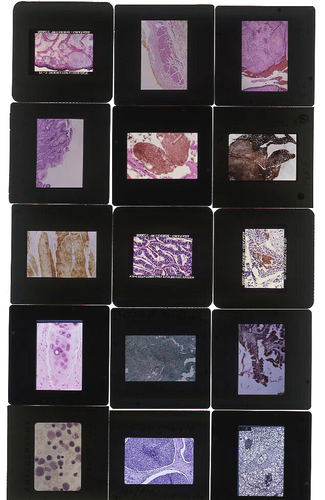 HUGE LOT OF 2,500 VINTAGE MEDICAL PATHOLOGY 35MM MICROSCOPIC SLIDES Blood Germs