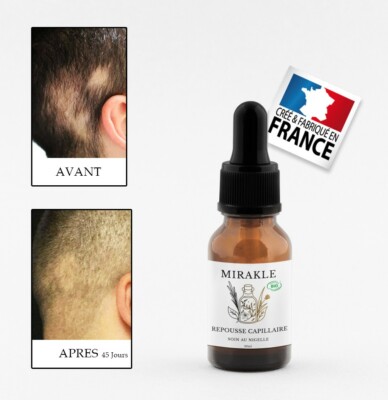 Sérum Repousse Capillaire BIO Mirakle - Anti-chute Cheveux (alopécie, Pelade) - Neuf