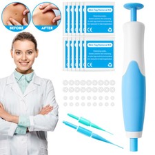 Auto Micro Skin Tag Remover Device Kit Safe Painless Removal 2-8 mm Band Tool