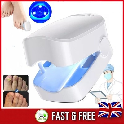 Nail Fungus Laser Device Light Therapy Onychomycosis Toes Treatment 100% New